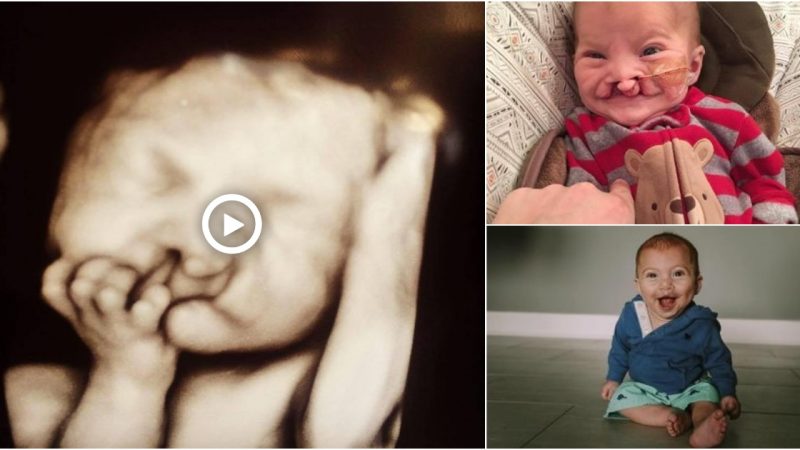 The mother decided to keep the fetus, when her baby was born with a deformity and an unexpected thing happened to her family