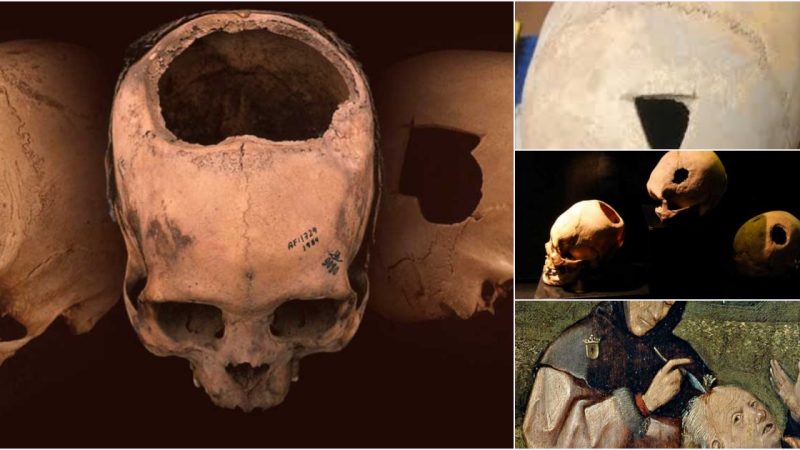 Neanderthal Skull Found in Turkey May Prove Magic Practiced 38,000 Years Ago