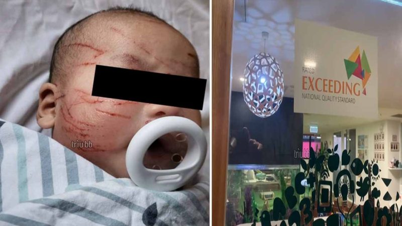 Baby, just 10 weeks old, badly scratched at Melbourne childcare Medics had to check the infant to ensure the 10-week-old’s eyes and brain had not been injured.