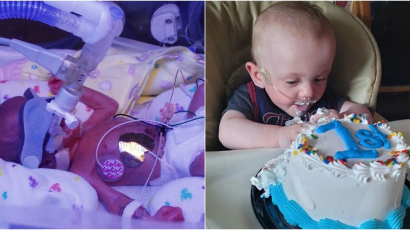 The world’s most premature baby with 0% chance of survival has overcome all challenges to celebrate her first birthday.