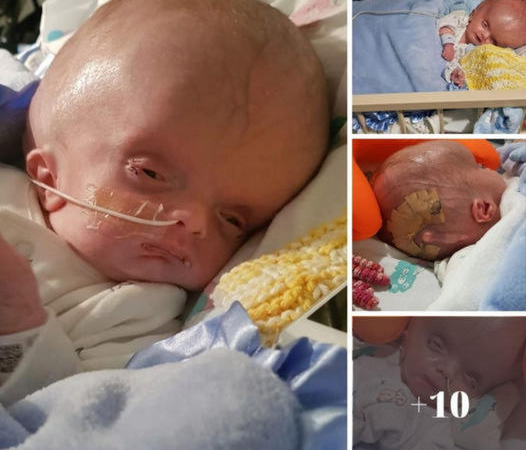 Against all odds: The remarkable survival of a boy with a swollen head and a fractured skull.