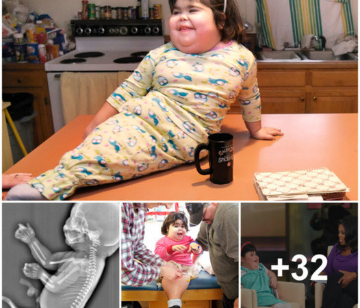 The Incredible Journey of the One-Legged Baby: Unveiling the Real-Life Extraordinary Story