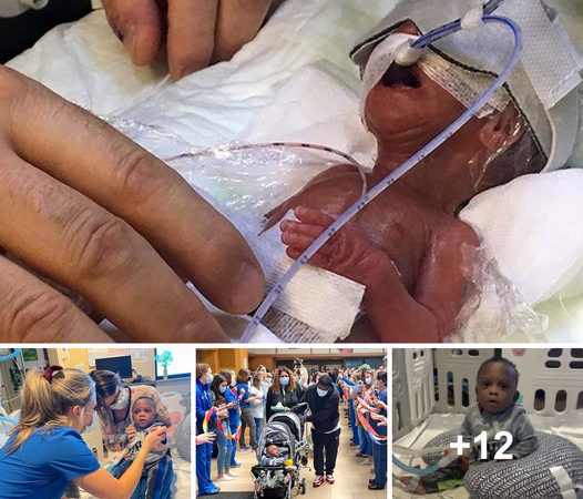 Conquering All Odds: The Inspiring Journey of Baby Kendall