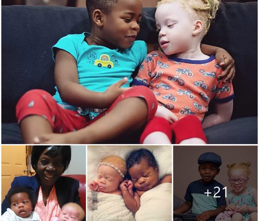 Twice the Love: The Inspiring Journey of a Mother with Black and White Twins Who Breaks Barriers and Ignites Conversations