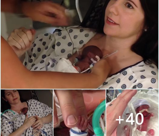 A Mother Embraces Her 15-Week Premature Infant with Gentle Affection.