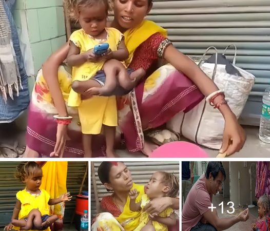 The Incredible Journey of a Bihar Girl with Four Arms and Four Legs