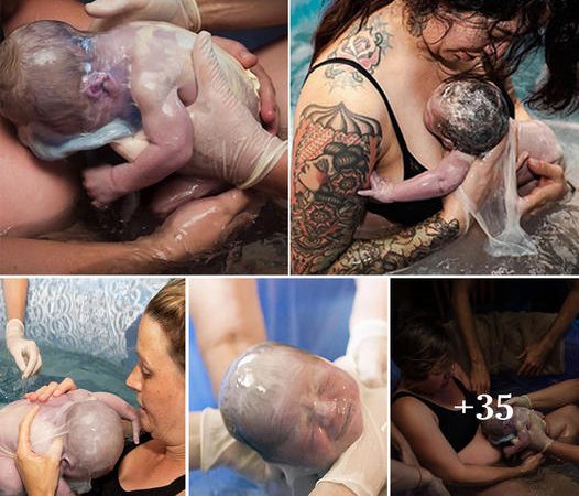 Magical Moments: Capturing the Rarity of Babies Born in the Amniotic Sac