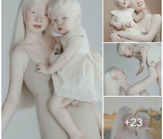 The Angelic Beauty of Two Sisters with Albinism