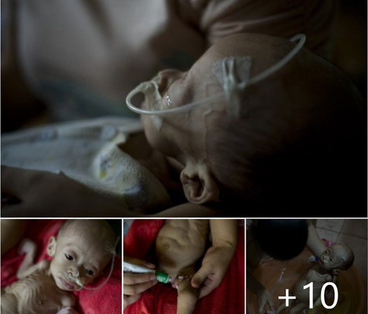 Marvel at the Remarkable Resilience of a Young Child Battling a Rare and Mysterious Illness