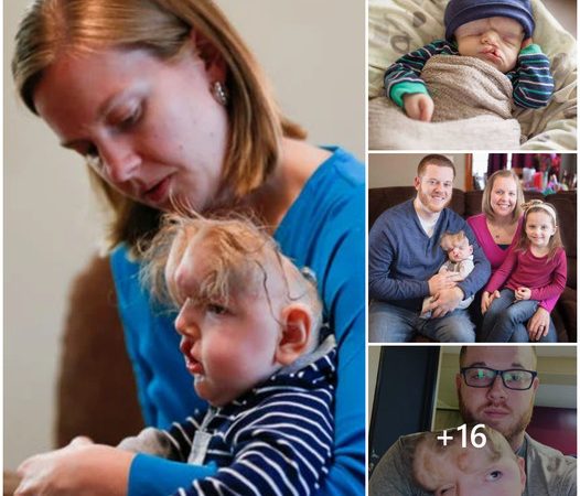 Miracle Boy: Born Without a Skull, Owen Celebrates His Remarkable First Birthday