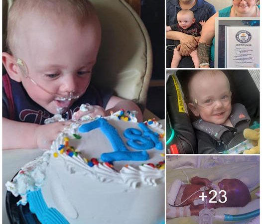 A Remarkable Journey: The Baby Who Defied All Odds and Celebrated His First Birthday