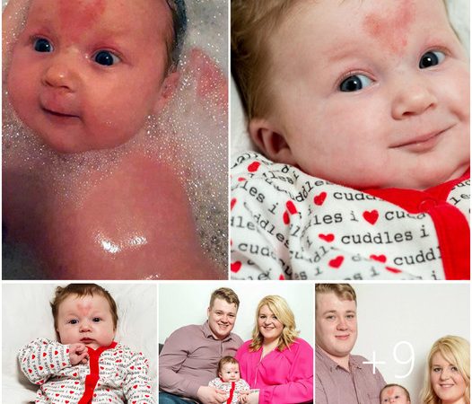 A Heartwarming Tale: Baby Poppy-Rae’s Love-Filled Birthmark