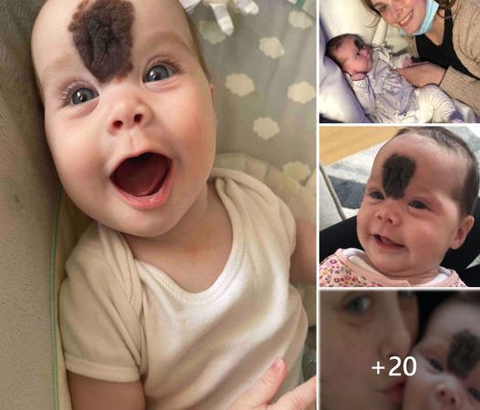 The Unwavering Spirit: Baby Vienna’s Journey with a Remarkable Birthmark