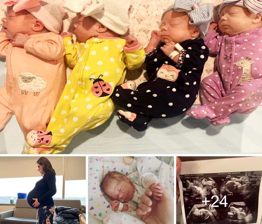 A Miracle Unfolds: A Couple’s Joyous Welcome to Rare Identical Quadruplet Daughters