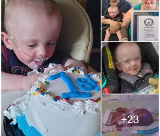 A Miracle: Baby Born Weighing Less Than 1 Pound Celebrates First Birthday Against All Odds