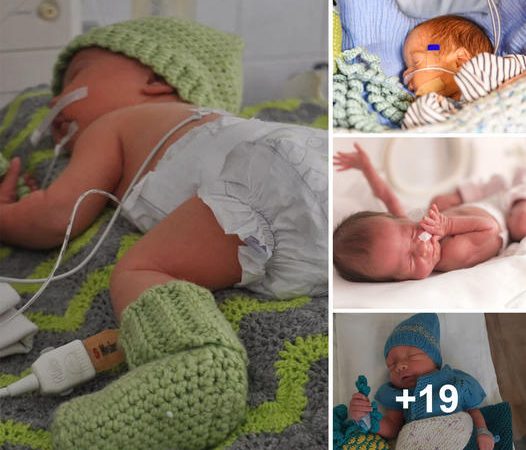 Miracle Baby’s Fight for Life: Theo’s Triumph Over a Heart-Stopping Ordeal