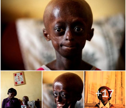 A Heartbreaking Saga: The Inspirational Story of Otlametse Phalatse