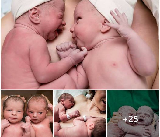 Capturing the Marvelous Bond of Twin Babies from Womb to World